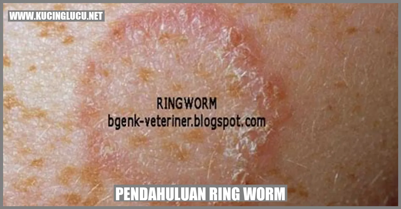 Ringworm