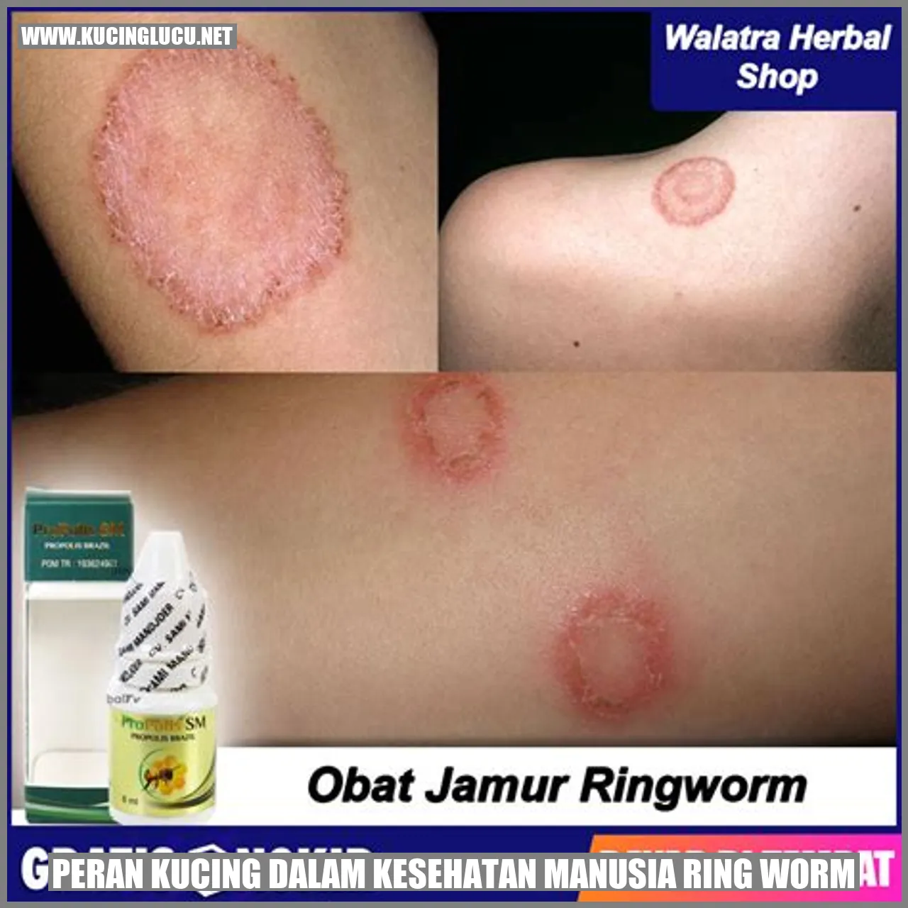 Peran Kucing dalam Kesehatan Manusia ring worm
