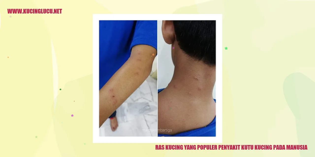 Ras Kucing yang Populer penyakit kutu kucing pada manusia
